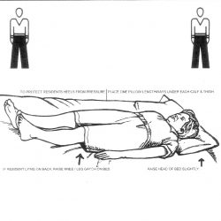 Positioning-Supine